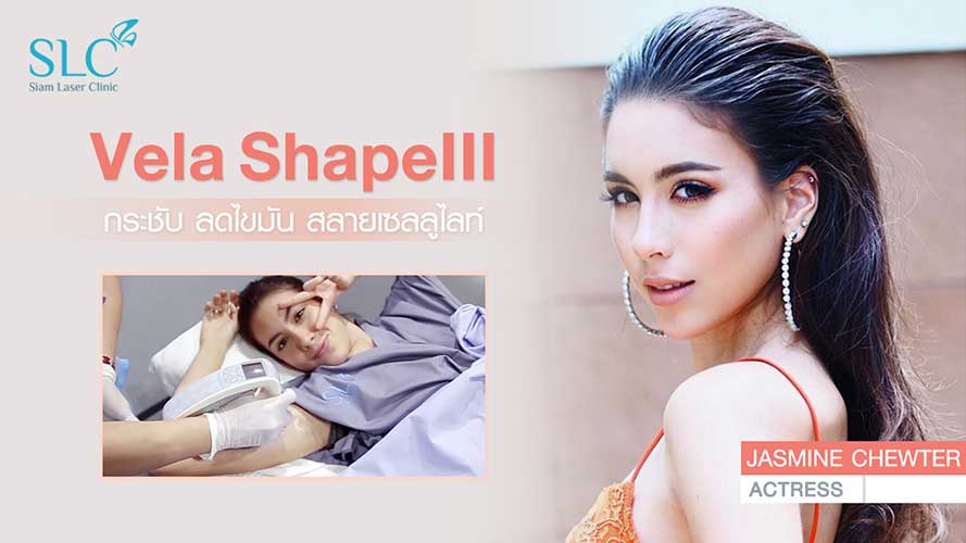 Velashape III | เจสซี่