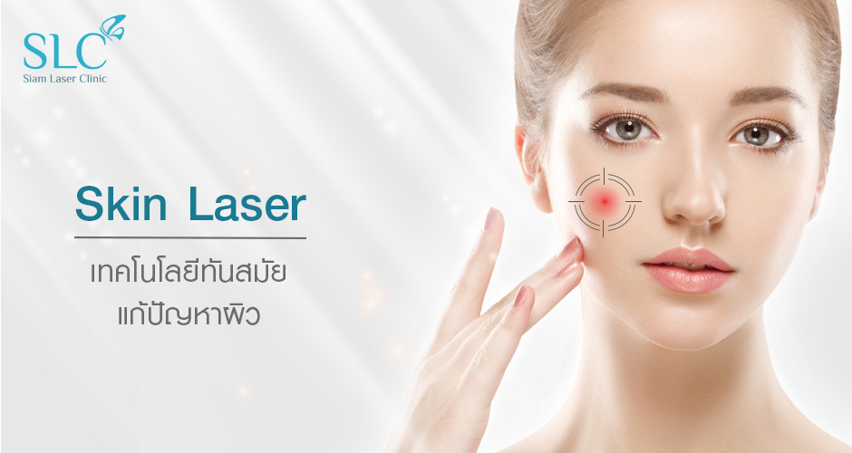 Skin Laser