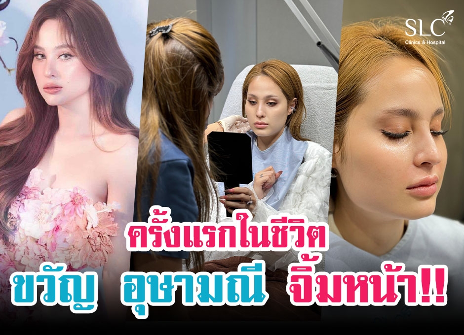 เปิดซิงจิ้มหน้า “ขวัญ อุษามณี” ด้วย Sculptra ทำจริงที่ SLC