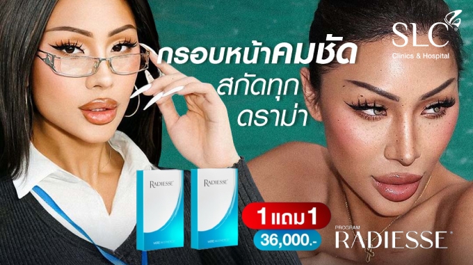 Radiesse ซื้อ 1 แถม 1 เพียง 36,000 บาท