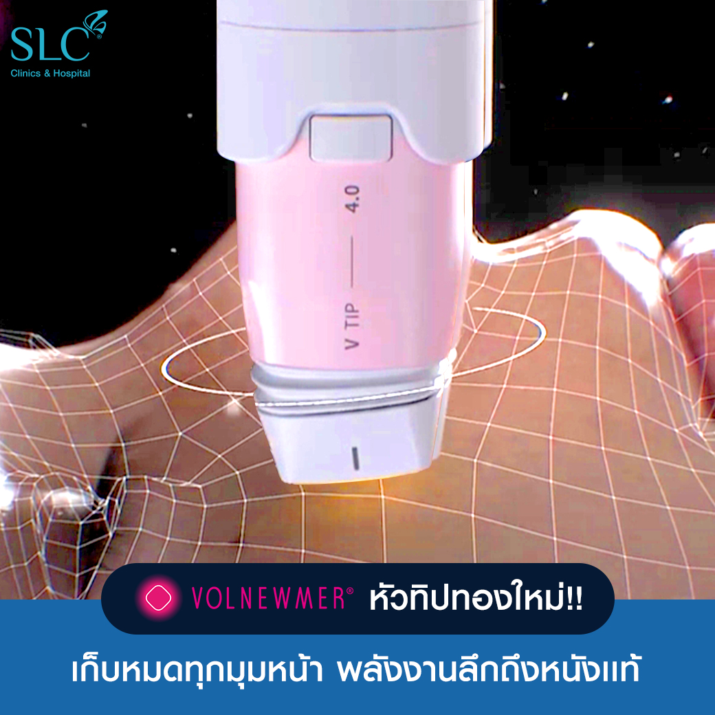 Volnewmer,Volnewmer คืออะไร,ยกกระชับผิวหน้า,ฟื้นฟูสภาพผิว, mono-polarRF,ผิวเต่งตึง,ลดไขมันส่วนเกิน,ผิวเรียบสวย,ยกกระชับไม่ต้องศัลยกรรม,ยกกระชับไม่ต้องศัลยกรรม