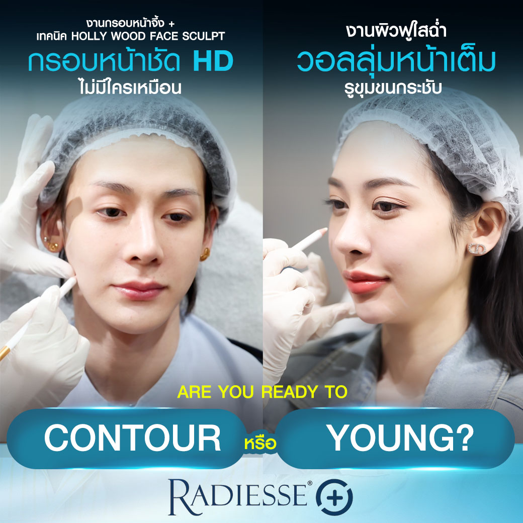 Radiesse+, เรเดียสพลัสตัวใหม่, Radiesseplus, RadiesseplusSLC, เรเดียสพลัส,เรเดียสตัวเก่าต่างจากเรเดียสตัวใหม่ยังไง, เทคนิคสร้างกรอบหน้า, Radiesse Classic