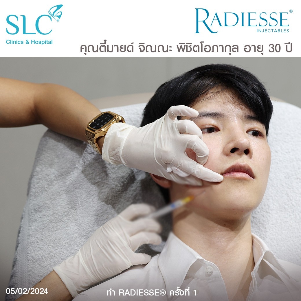 รีวิว Radiesse, Radiesse ดีไหม, เรเดียสดีไหม, รีวิวเรเดียส, หน้าแห้ง, ผิวยับ, ผิวหย่อนคล้อย