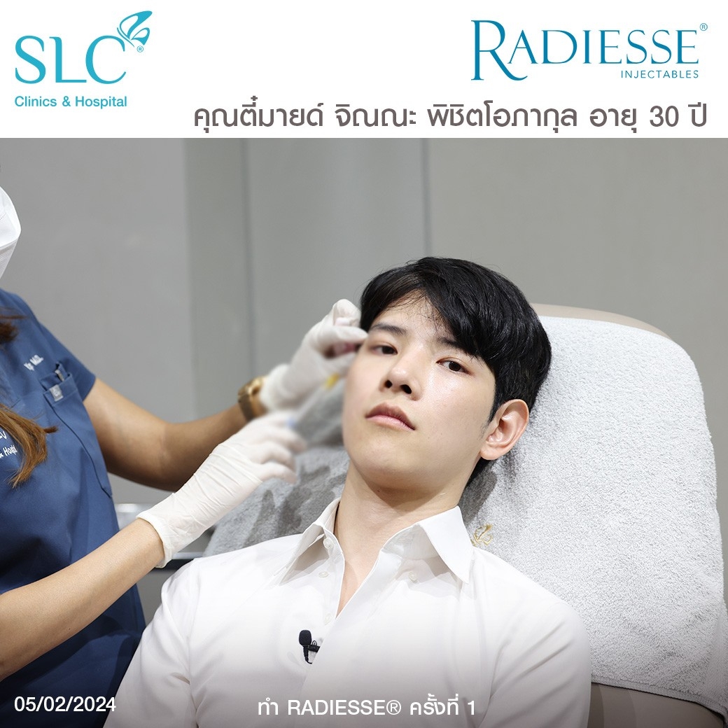 รีวิว Radiesse, Radiesse ดีไหม, เรเดียสดีไหม, รีวิวเรเดียส, หน้าแห้ง, ผิวยับ, ผิวหย่อนคล้อย