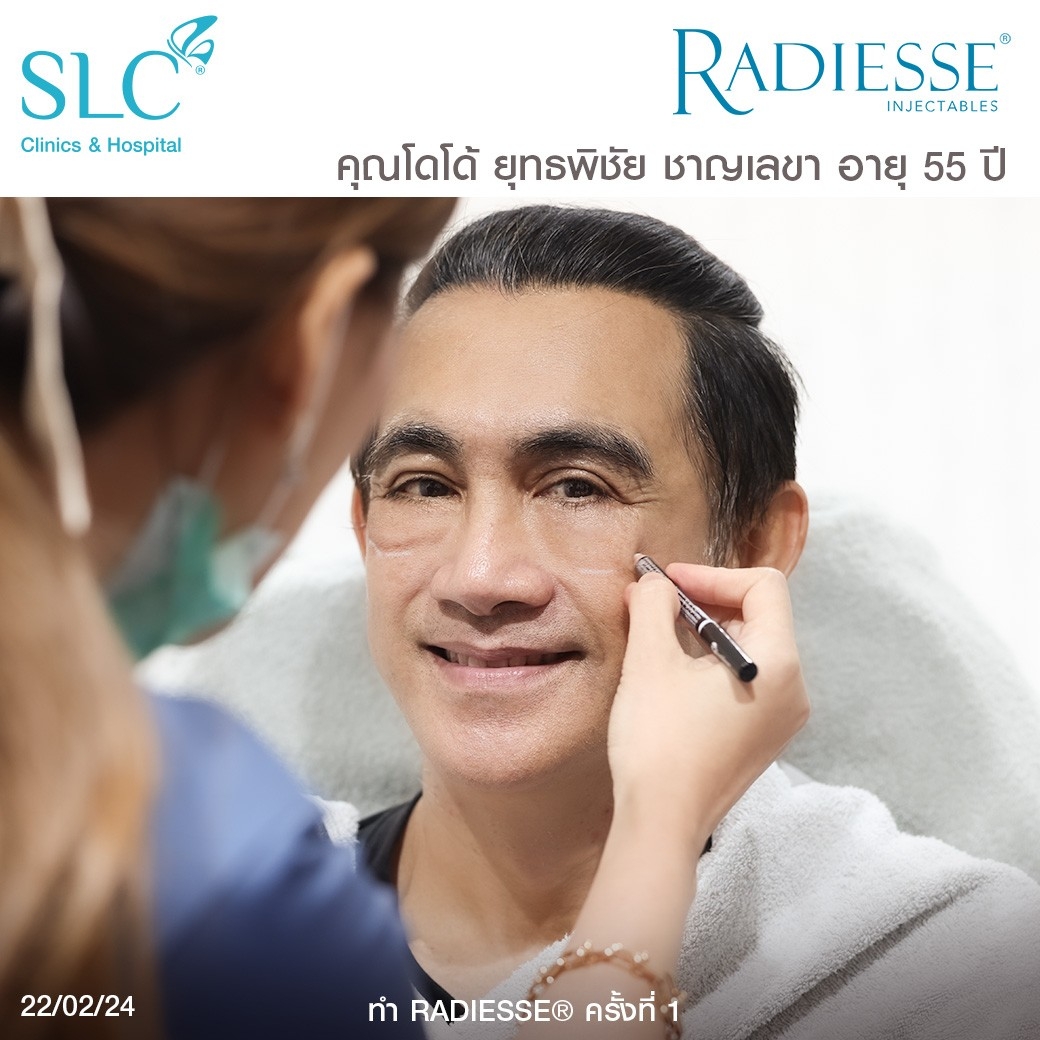 รีวิว Radiesse, Radiesse ดีไหม, เรเดียสดีไหม, รีวิวเรเดียส, หน้าแห้ง, ผิวยับ, ผิวหย่อนคล้อย