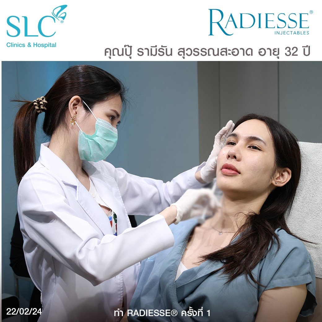 รีวิว Radiesse, Radiesse ดีไหม, เรเดียสดีไหม, รีวิวเรเดียส, หน้าแห้ง, ผิวยับ, ผิวหย่อนคล้อย