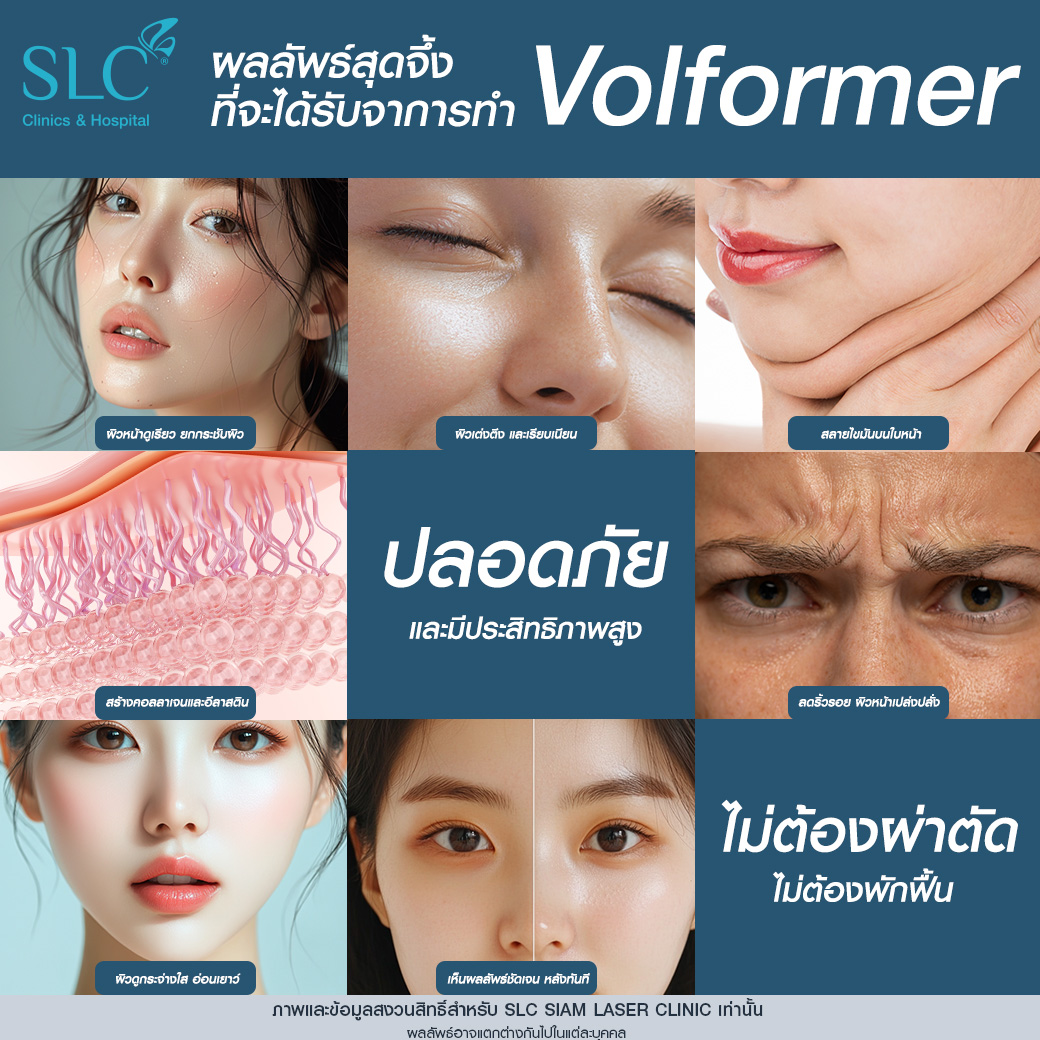 Volnewmer, MPT4DLift, Volformer, SLC Clinic