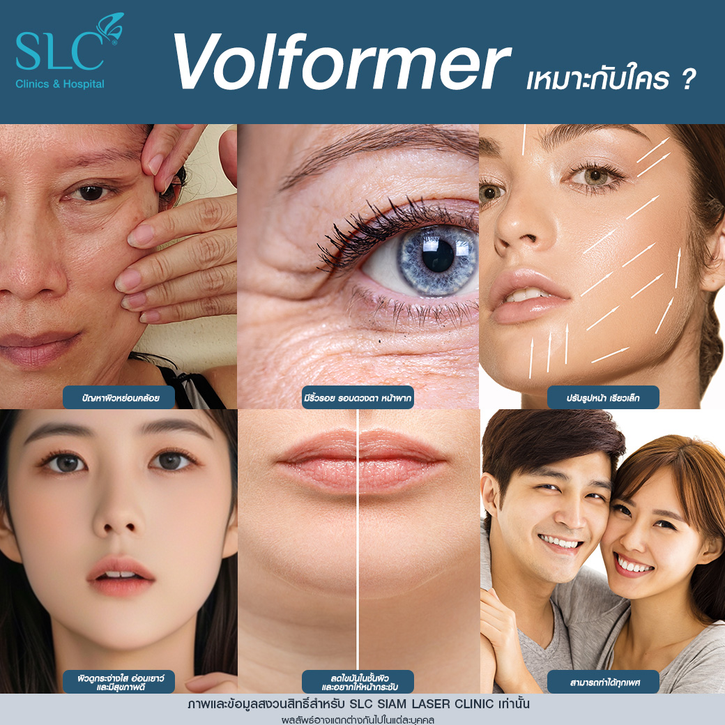 Volnewmer, MPT4DLift, Volformer, SLC Clinic