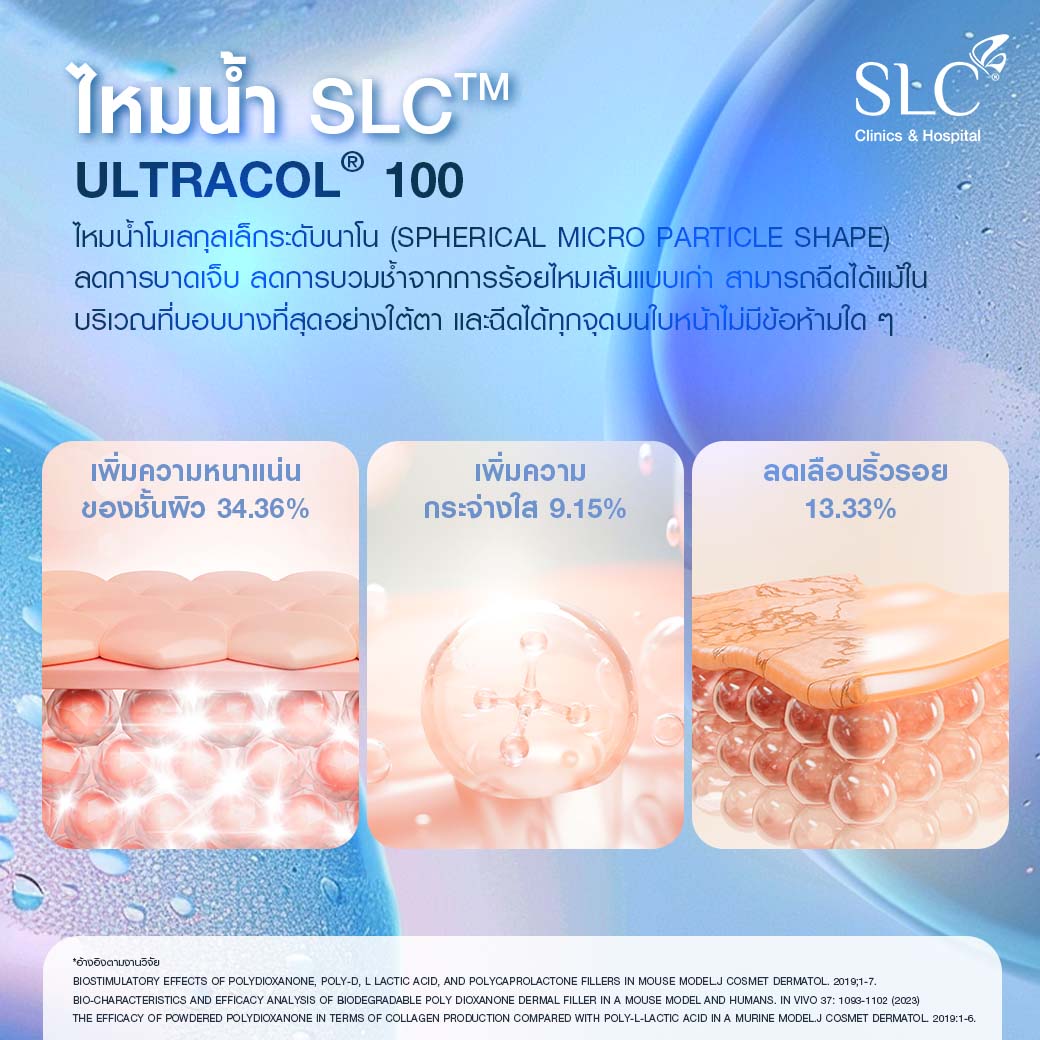 ไหมน้ำ, ไหมน้ำ SLC , SLC ไหมน้ำสะบัดคอลลาเจน, Ultracol 100 , ฉีดกระตุ้นคอลลาเจนผิว, Collagen Biostimulator, ไหมน้ำ คือ, ฉีดไหมน้ำ รีวิว, ultracol ใต้ตา