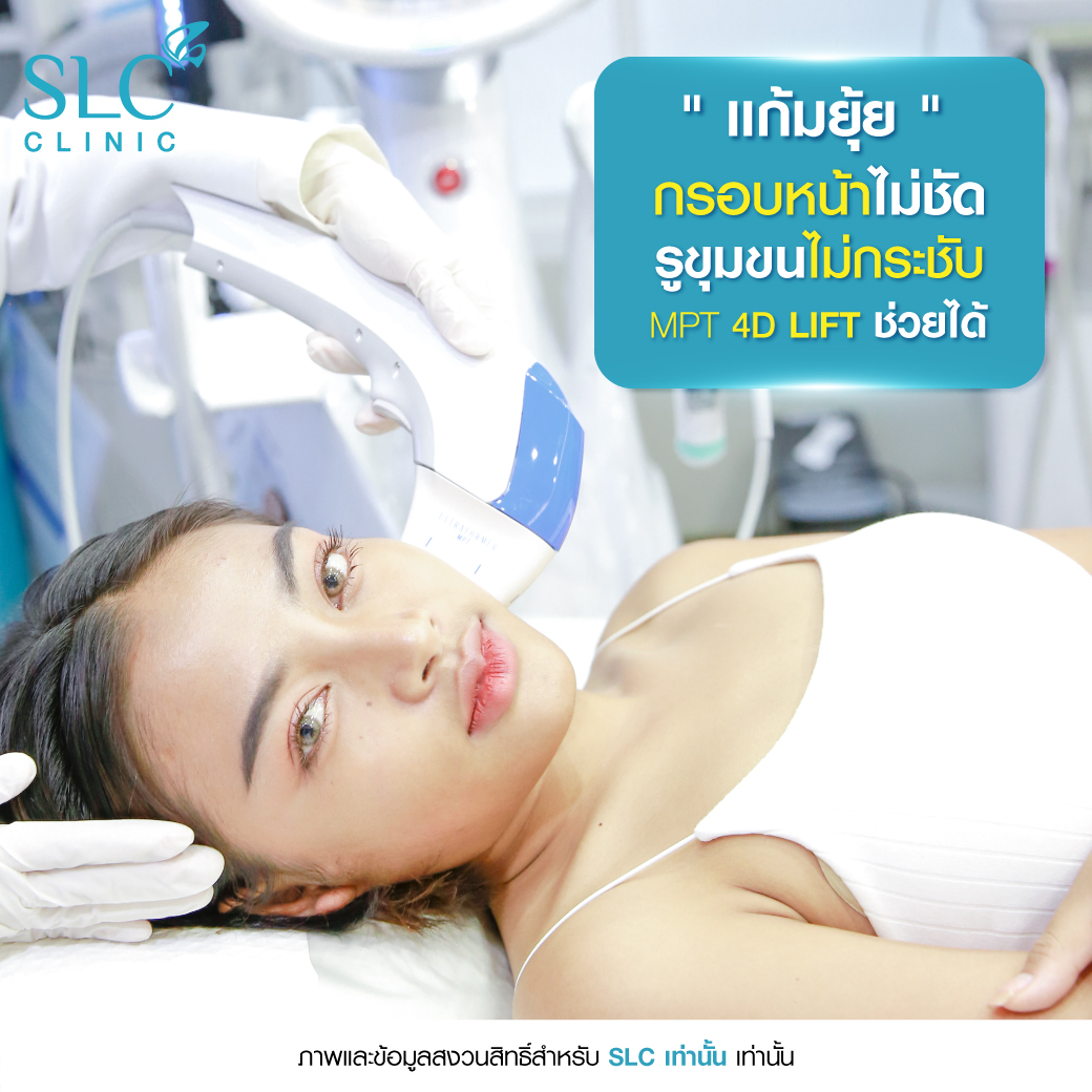 UltraformerSLC, volnewmersIc, รีวิวLiftingSLC, ยกกระชับหน้า