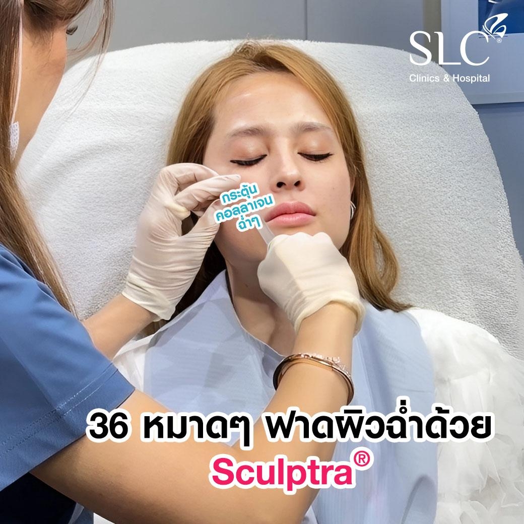 ฉีดคอลลาเจน, Sculptra, รีวิว Sculptra, รีวิวฉีดคอลลาเจน, รีวิวงานผิว, ขวัญอุษามณี, ขวัญอุษามณีฉีดหน้า, ขวัญอุษามณีจิ้มหน้า, ขวัญอุษามณีทำหน้า