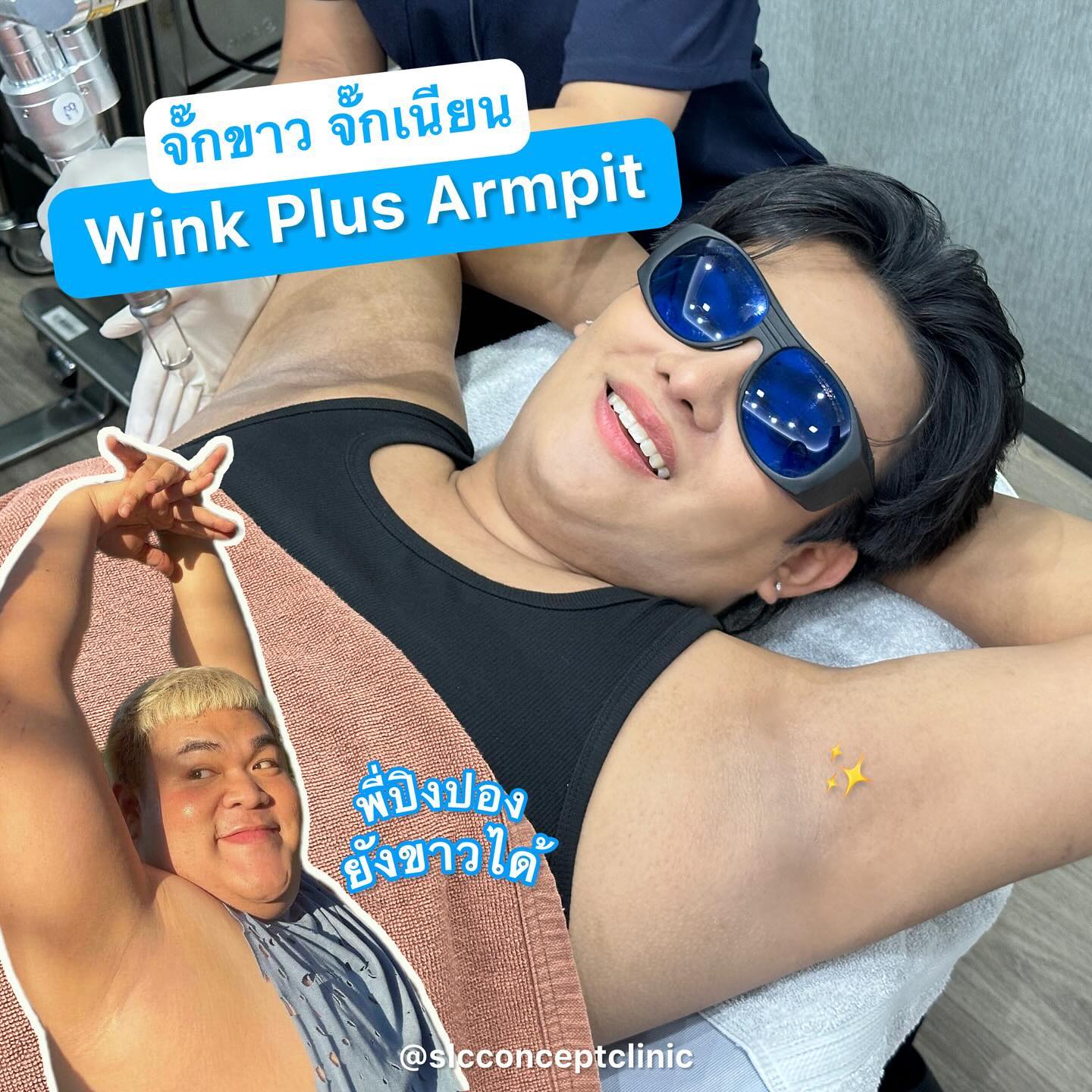 Wink Plus Armpit, White Armpit, รักแร้ขาว, เลเซอร์รักแร้,เลเซอร์ขน,กำจัดขน,รักแร้เนียนใส,แก้รักแร้ดำ, เลเซอร์รักแร้ขาว, รักแร้ดําแก้ยังไง, รักแร้ดําเกิดจากอะไร, รักษารักแร้ดํา,ทํายังไงให้รักแร้ขาว,  ทรีตเมนต์รักแร้ขาว, วิธีทำให้รักแร้ขาว