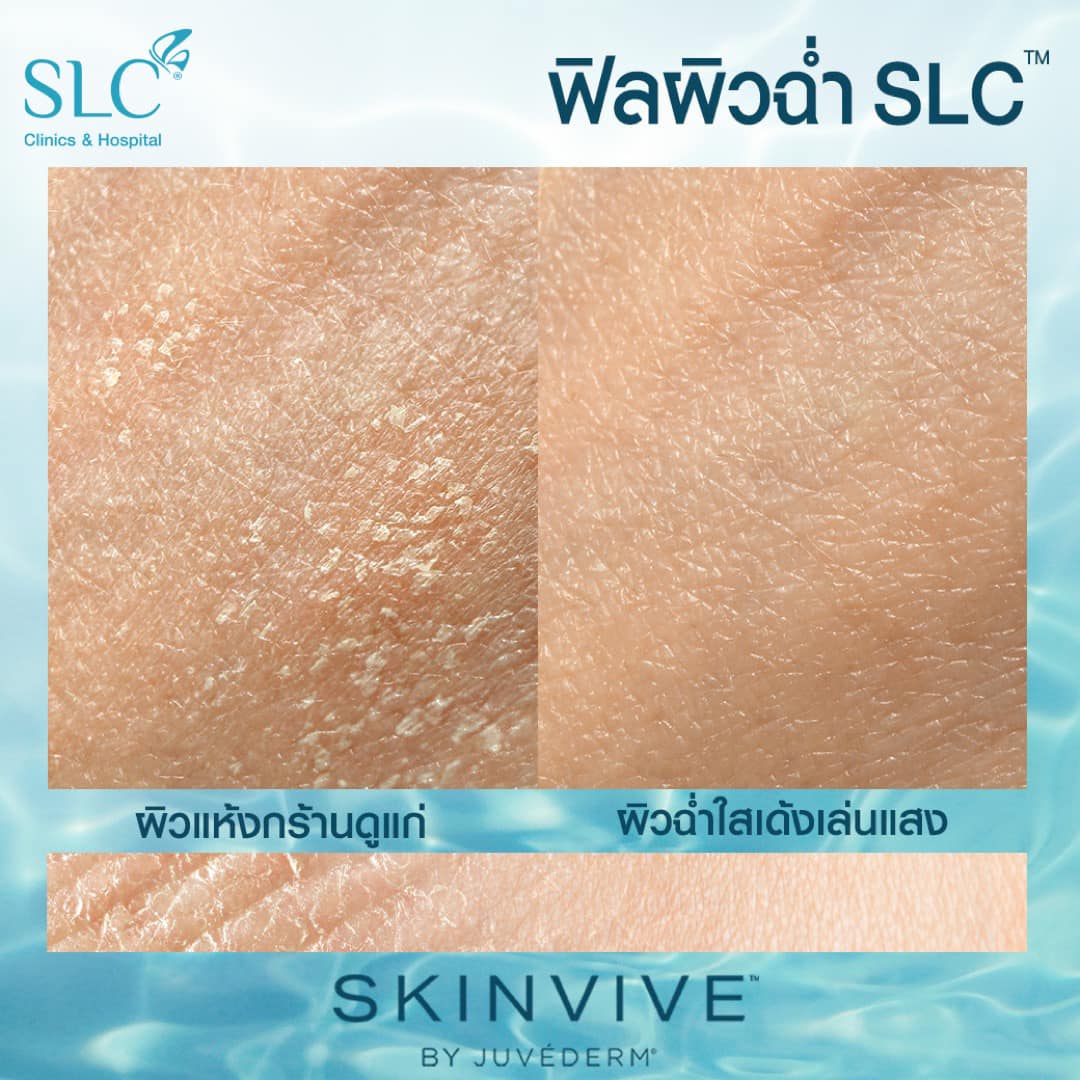 ฟิลผิวฉ่ำ SLC™, SKINVIVE™ , อยากผิวฉ่ำทำยังไง, หน้าแห้งแก้ยังไง, ผิวขาดน้ำ