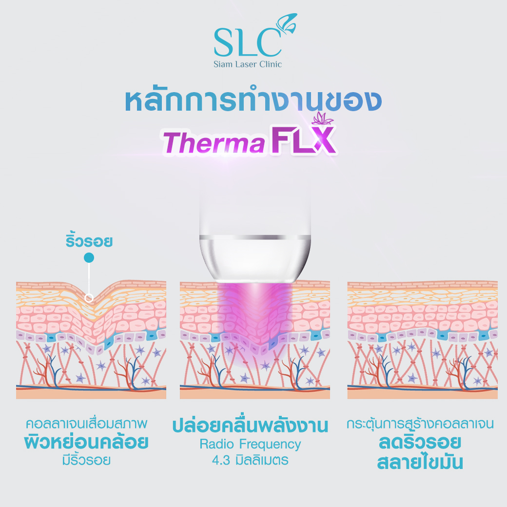  เครื่องยกหน้า, เครื่องยกกระชับ, ยกกระชับหน้า, Ulthera, Volnewmer, MPT 4 D Lift, Emface, Morpheus 8, Thermage, หัตถการยกกระชับหน้า, เครื่องยกกระชับหน้า