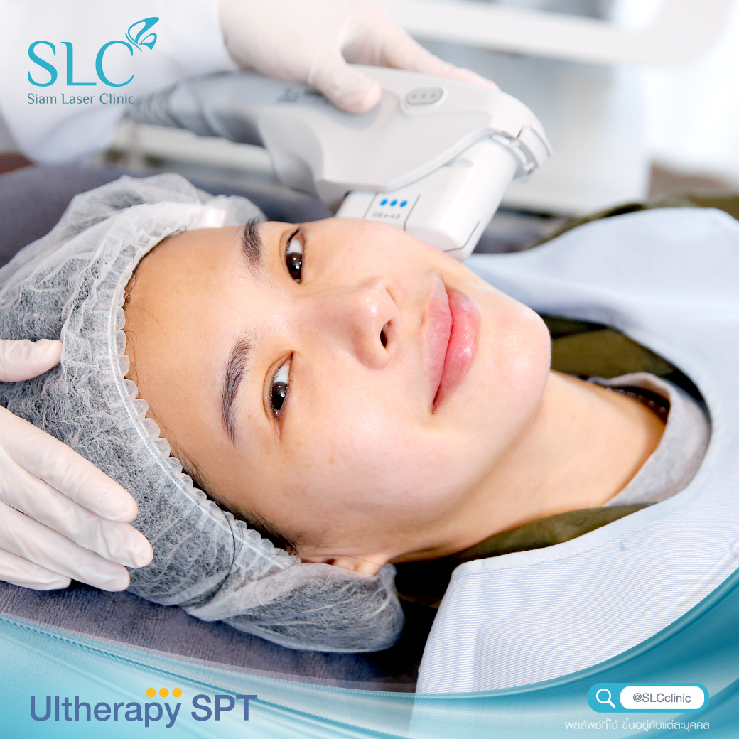 Ultherapy SPT, Ulthera