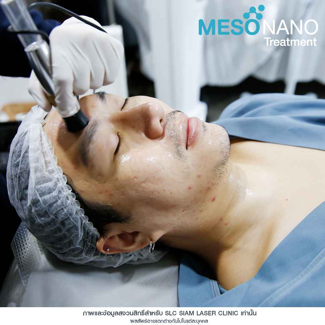 Meso Nano Treatment 