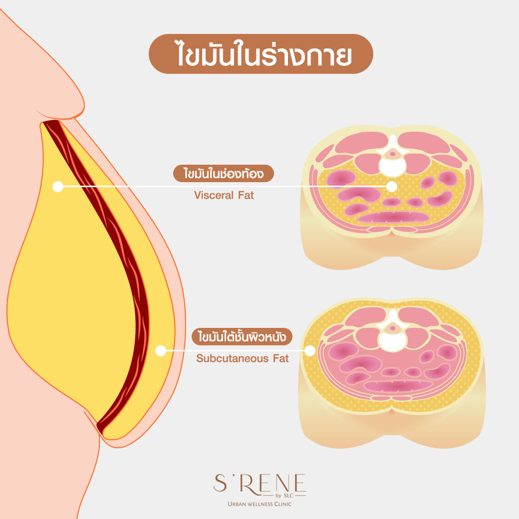 ไขมันในช่องท้อง,ไขมันในช่องท้อง ไม่ควรเกิน,ไขมันในช่องท้อง คือ,ค่า ไขมันในช่องท้อง visceral fat,ผอมแต่มีพุง,พุงหมาน้อย,DEXA SCAN,S'RENE by SLC,ตรวจวัดไขมันสะสมทั่วร่างกาย,ตรวจมวลกล้ามเนื้อ,ตรวจเช็คความหนาแน่นของมวลกระดูก 