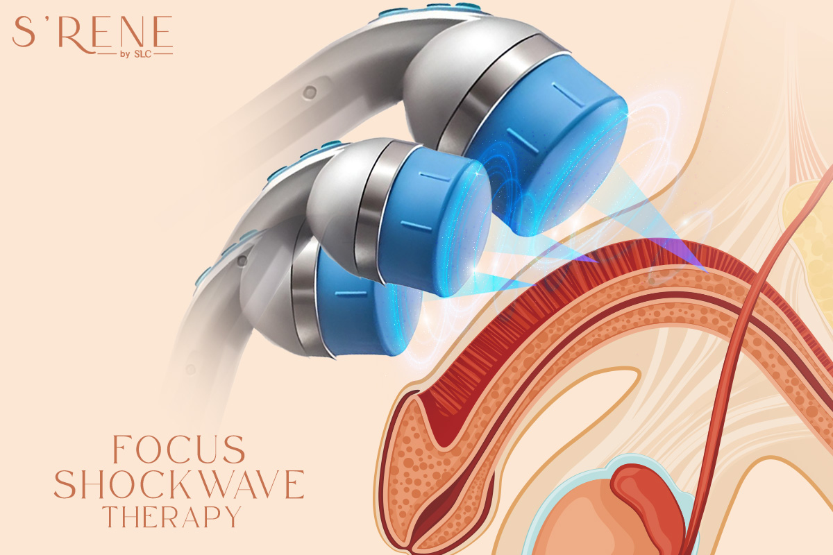 Focus Shockwave Therapy แก้ปัญหาอาการปวดเรื้อรัง และโรคหย่อนสมรรถภาพทางเพศ