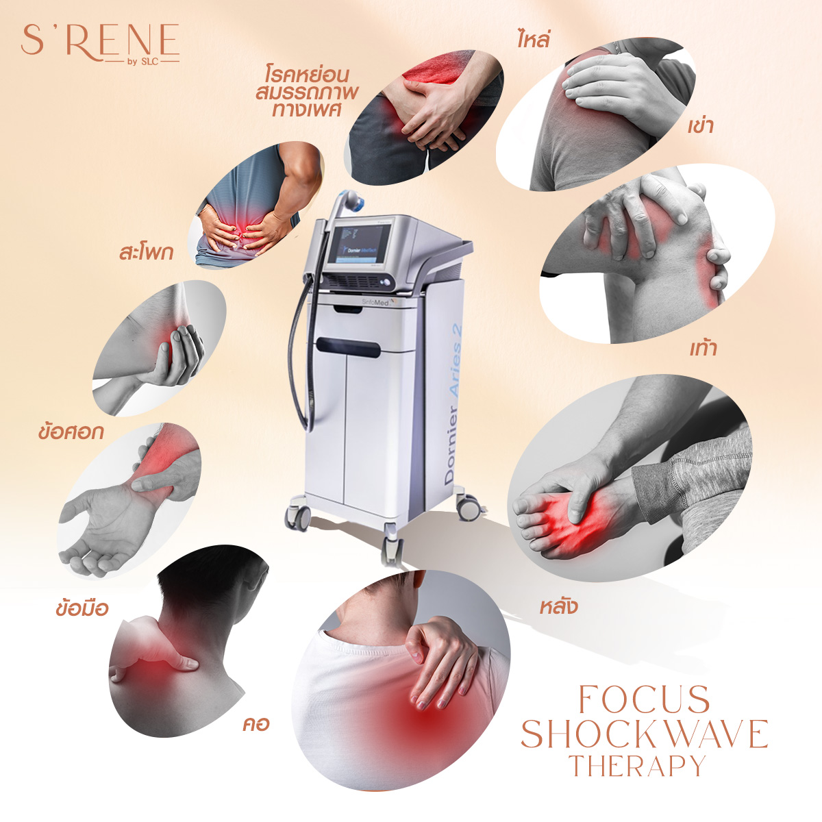 Focus Shockwave Therapy แก้ปัญหาอาการปวดเรื้อรัง และโรคหย่อนสมรรถภาพทางเพศ