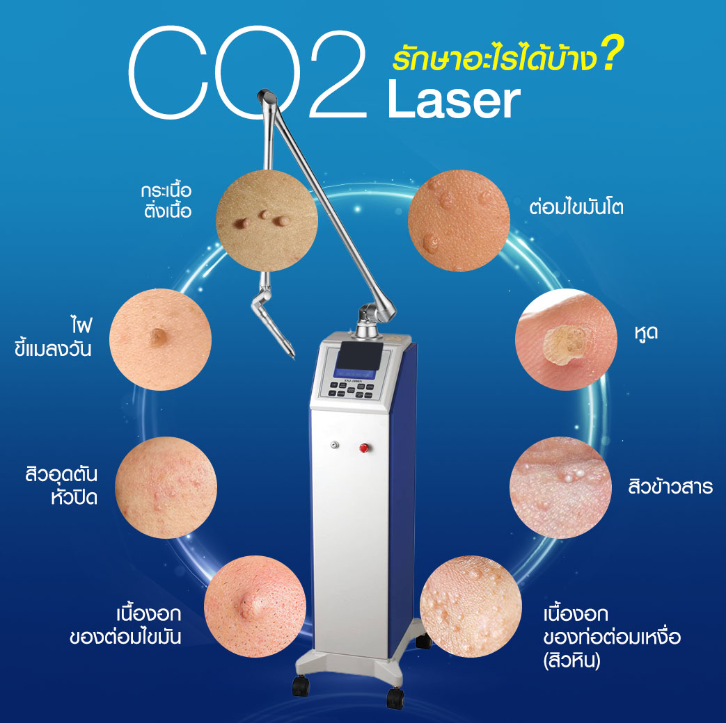 เลเซอร์ Co2, เลเซอร์ติ่งเนื้อ, ตัด ติ่งเนื้อ, คลินิก จี้ไฝ, กําจัด กระเนื้อ, ลบขี้แมลงวัน,co2 laser คือ, co2 laser ที่ไหนดี, ทํา fractional co2 laser, co2 laser กระเนื้อ