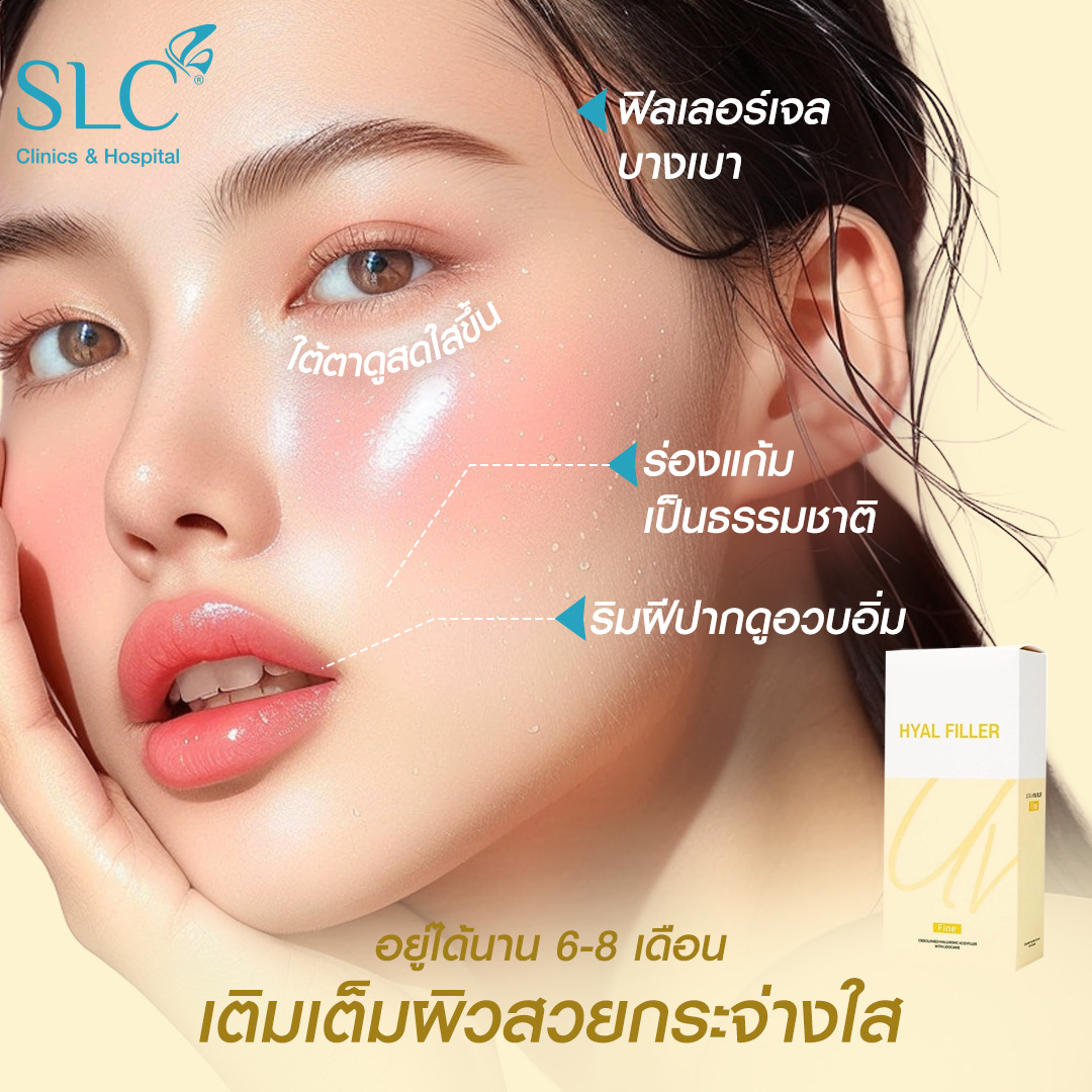 Hyal filler คืออะไร, hyaluron filler, filler hyaluronic acid, ultra v hyal filler, hya filler คือ, รีวิว Hyal filler, Hyal filler ช่วยอะไร,  Hyal filler 