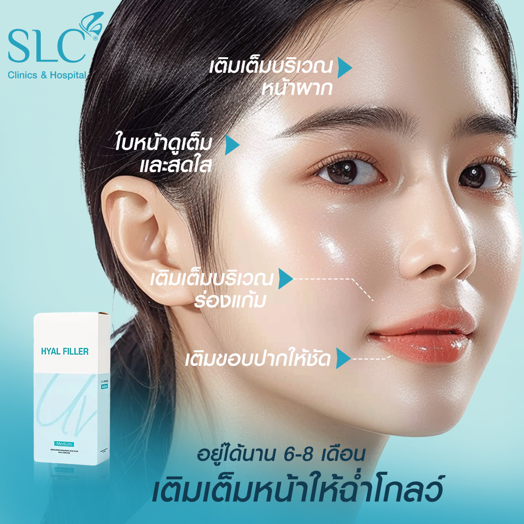 Hyal filler คืออะไร, hyaluron filler, filler hyaluronic acid, ultra v hyal filler, hya filler คือ, รีวิว Hyal filler, Hyal filler ช่วยอะไร,  Hyal filler 