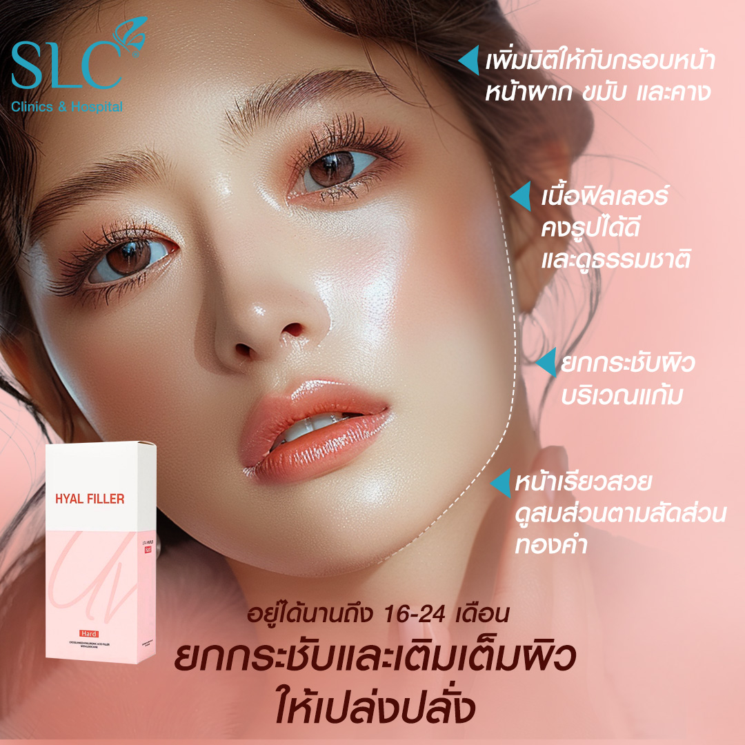 Hyal filler คืออะไร, hyaluron filler, filler hyaluronic acid, ultra v hyal filler, hya filler คือ, รีวิว Hyal filler, Hyal filler ช่วยอะไร,  Hyal filler 