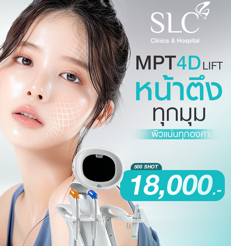 UltraformerSLC, volnewmersIc, รีวิวLiftingSLC, ยกกระชับหน้า