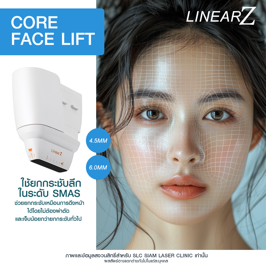 Linear Z, Linear Z คือ, ยกกระชับ, Hifu, ไฮฟู่, ยกกระชับหน้าเรียว, อยากหน้าเด็ก