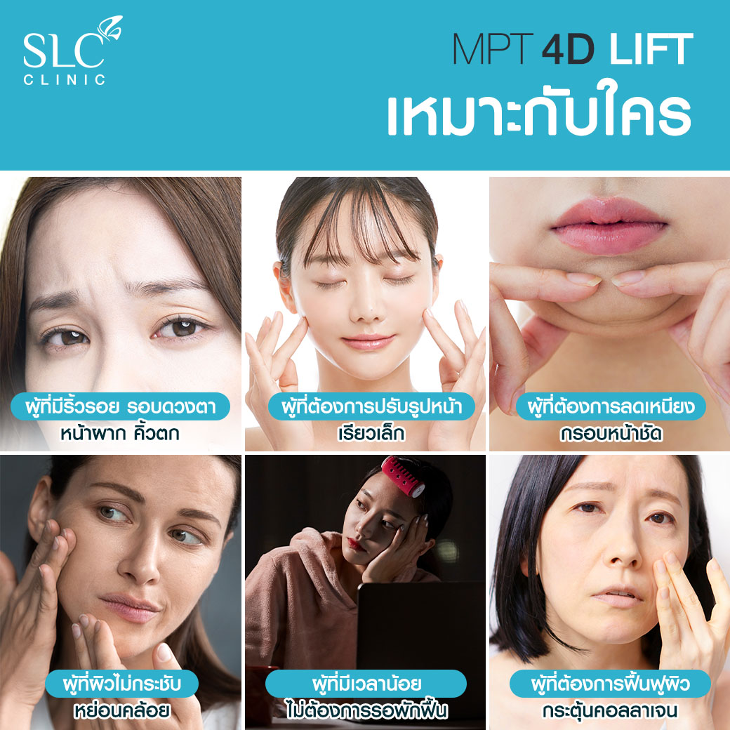 UltraformerSLC, volnewmersIc, รีวิวLiftingSLC, ยกกระชับหน้า