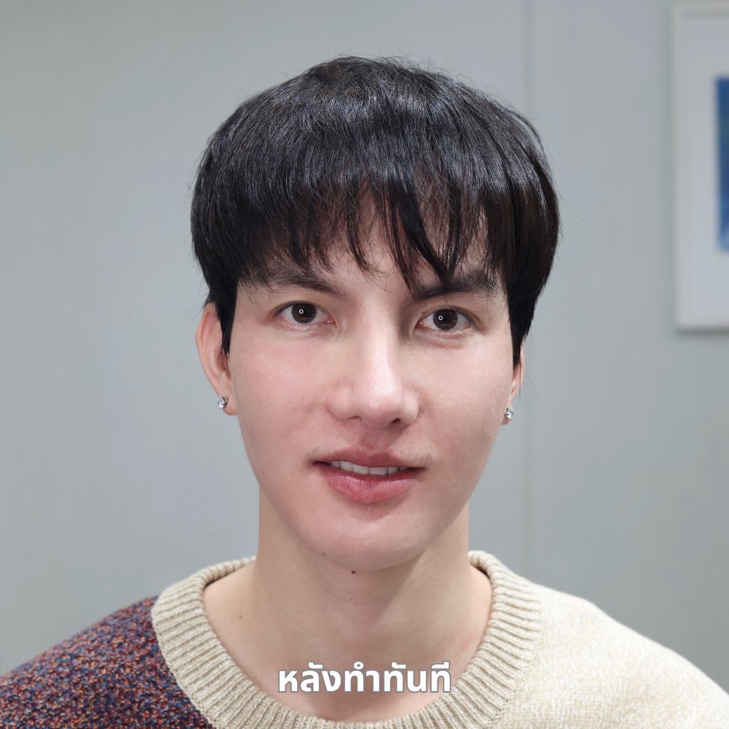 ไหมน้ำ, ไหมน้ำรีวิว, ไหมน้ำอยู่ได้นานไหม, ไหมน้ำดีไหม, ultracol 100, ultracol, ultracol ใต้ตา,ไหมน้ำ SLC