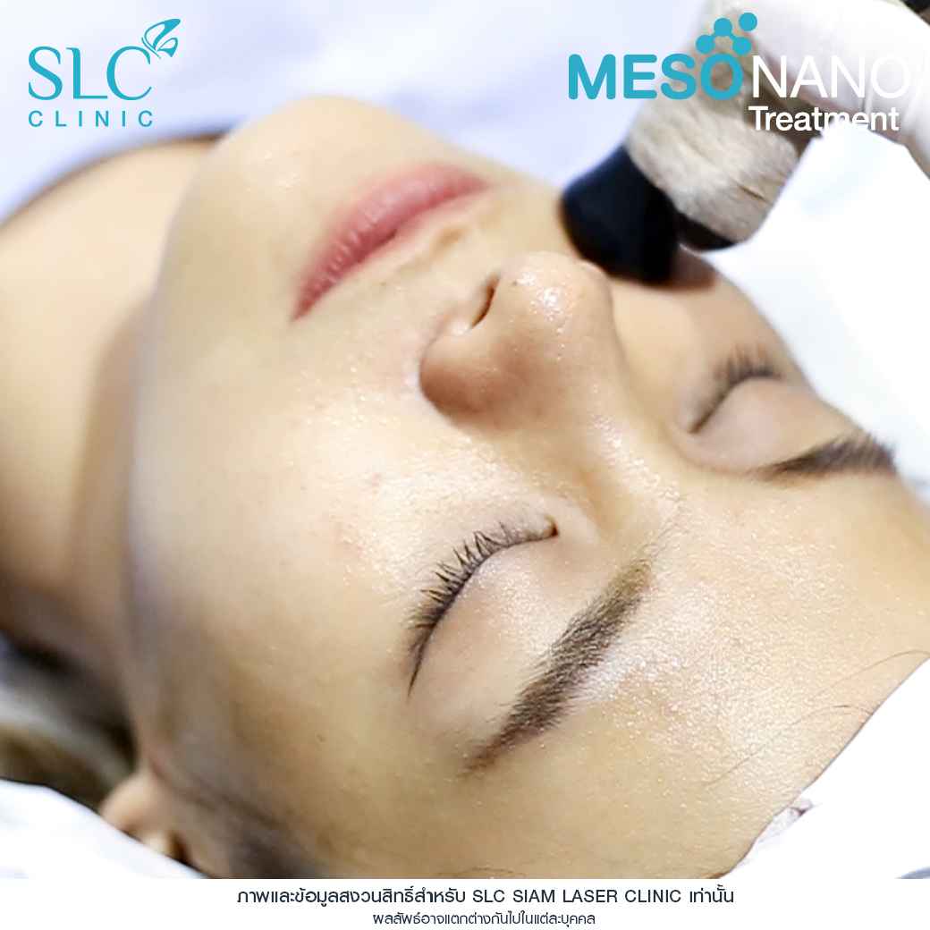 Meso Nano Treatment