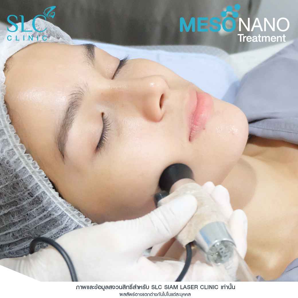 Meso Nano Treatment