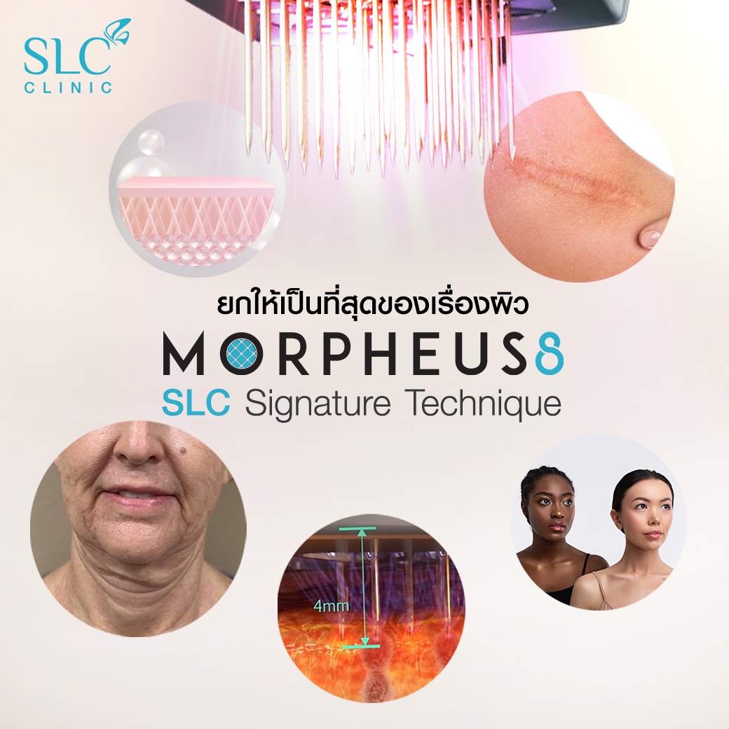 Morpheus8_ยกกระชับ_มอร์เฟียสเอท_Morpheus 8 SLC Signature Technique