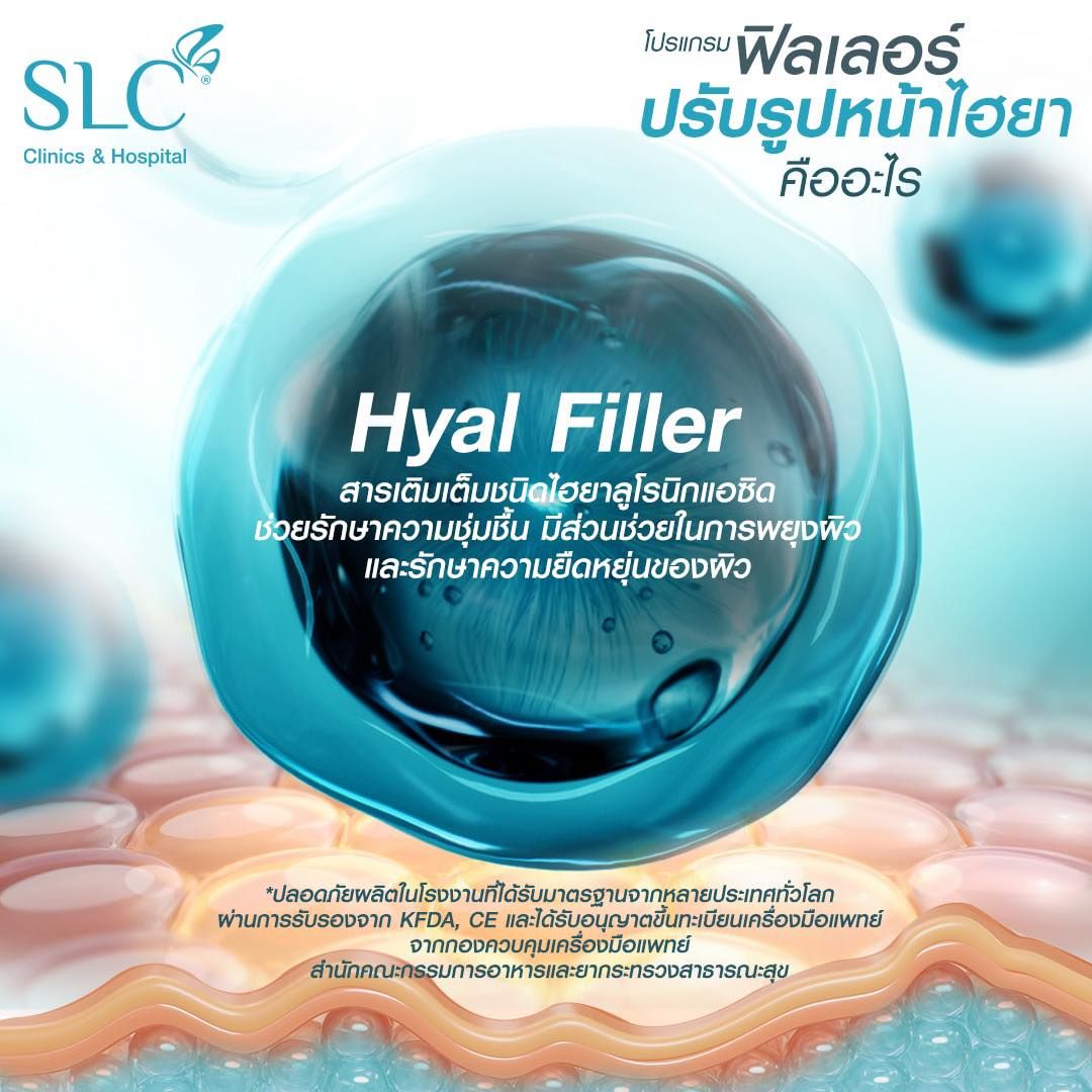 Ultra V Hyal Filler, ฟิล พส จีน