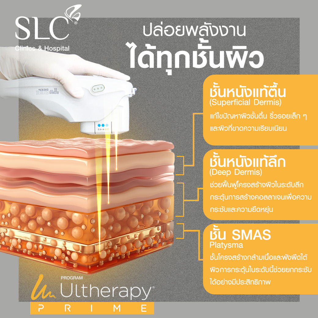 Ultherapy Prime, อัลเทอราปี ไพรม์, ยกกระชับหน้าแบบไม่เจ็บ, ยกกระชับหน้าแบบต้องไม่ผ่าตัด , ยกกระชับใบหน้า , UltheraSLC , Ultherapy , Prime , อัลเทอรา , UltherapySLC , UltherapyPrimeSLC