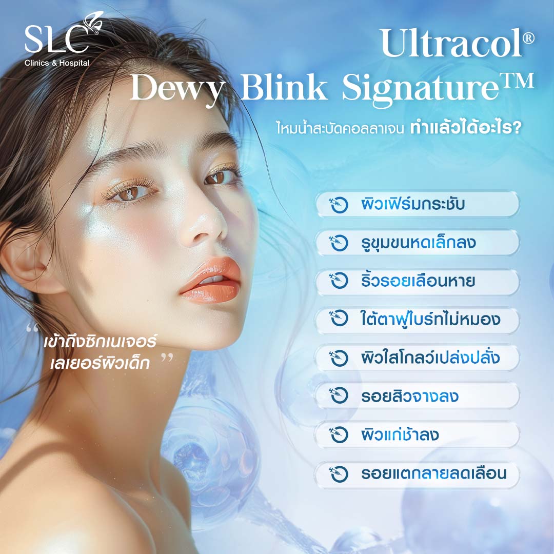 ไหมน้ำ, ไหมน้ำ SLC , SLC ไหมน้ำสะบัดคอลลาเจน, Ultracol 100 , ฉีดกระตุ้นคอลลาเจนผิว, Collagen Biostimulator, ไหมน้ำ คือ, ฉีดไหมน้ำ รีวิว, ultracol ใต้ตา