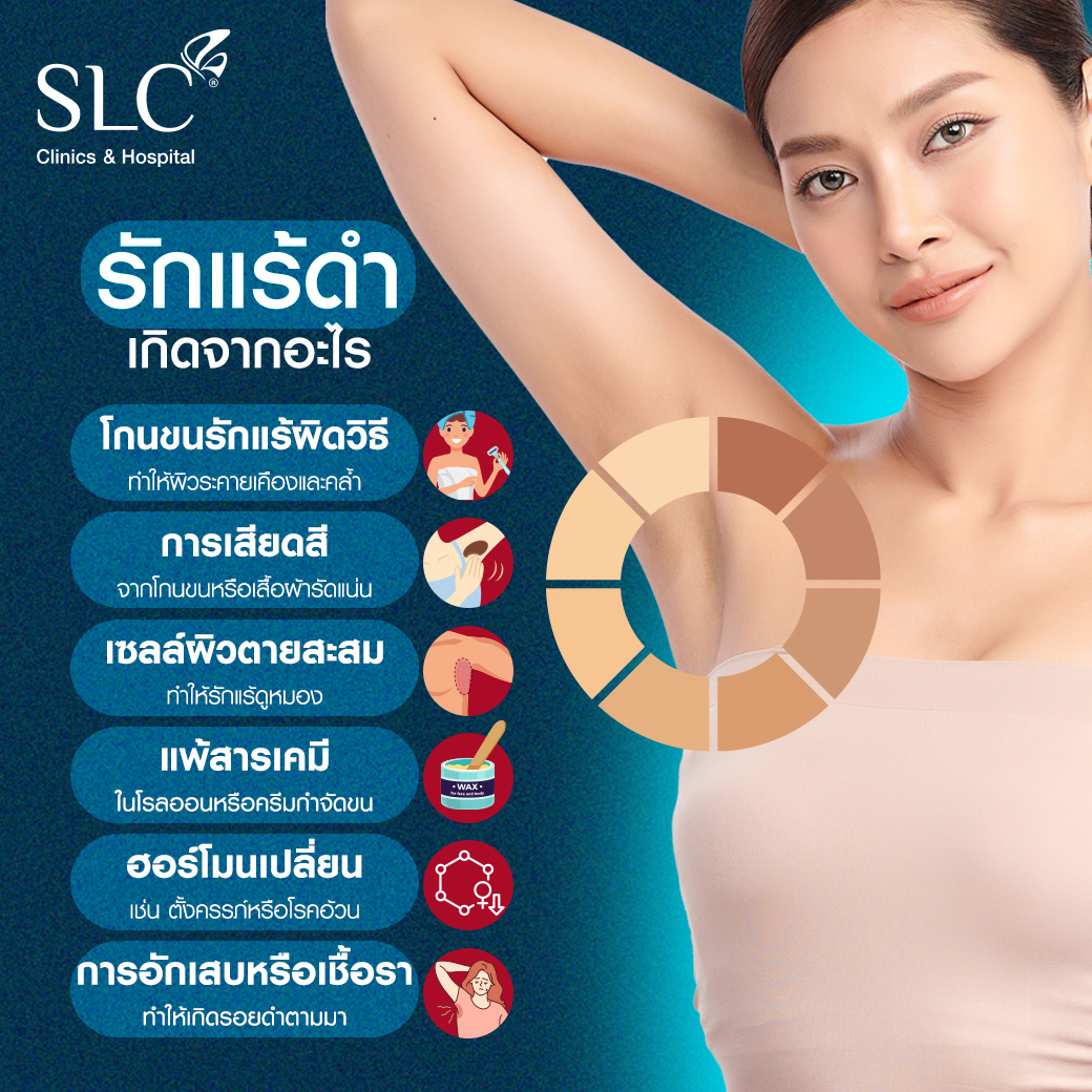 Wink Plus Armpit, White Armpit, รักแร้ขาว, เลเซอร์รักแร้,เลเซอร์ขน,กำจัดขน,รักแร้เนียนใส,แก้รักแร้ดำ, เลเซอร์รักแร้ขาว, รักแร้ดําแก้ยังไง, รักแร้ดําเกิดจากอะไร, รักษารักแร้ดํา,ทํายังไงให้รักแร้ขาว,  ทรีตเมนต์รักแร้ขาว, วิธีทำให้รักแร้ขาว