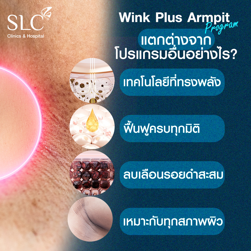 Wink Plus Armpit, White Armpit, รักแร้ขาว, เลเซอร์รักแร้,เลเซอร์ขน,กำจัดขน,รักแร้เนียนใส,แก้รักแร้ดำ, เลเซอร์รักแร้ขาว, รักแร้ดําแก้ยังไง, รักแร้ดําเกิดจากอะไร, รักษารักแร้ดํา,ทํายังไงให้รักแร้ขาว,  ทรีตเมนต์รักแร้ขาว, วิธีทำให้รักแร้ขาว