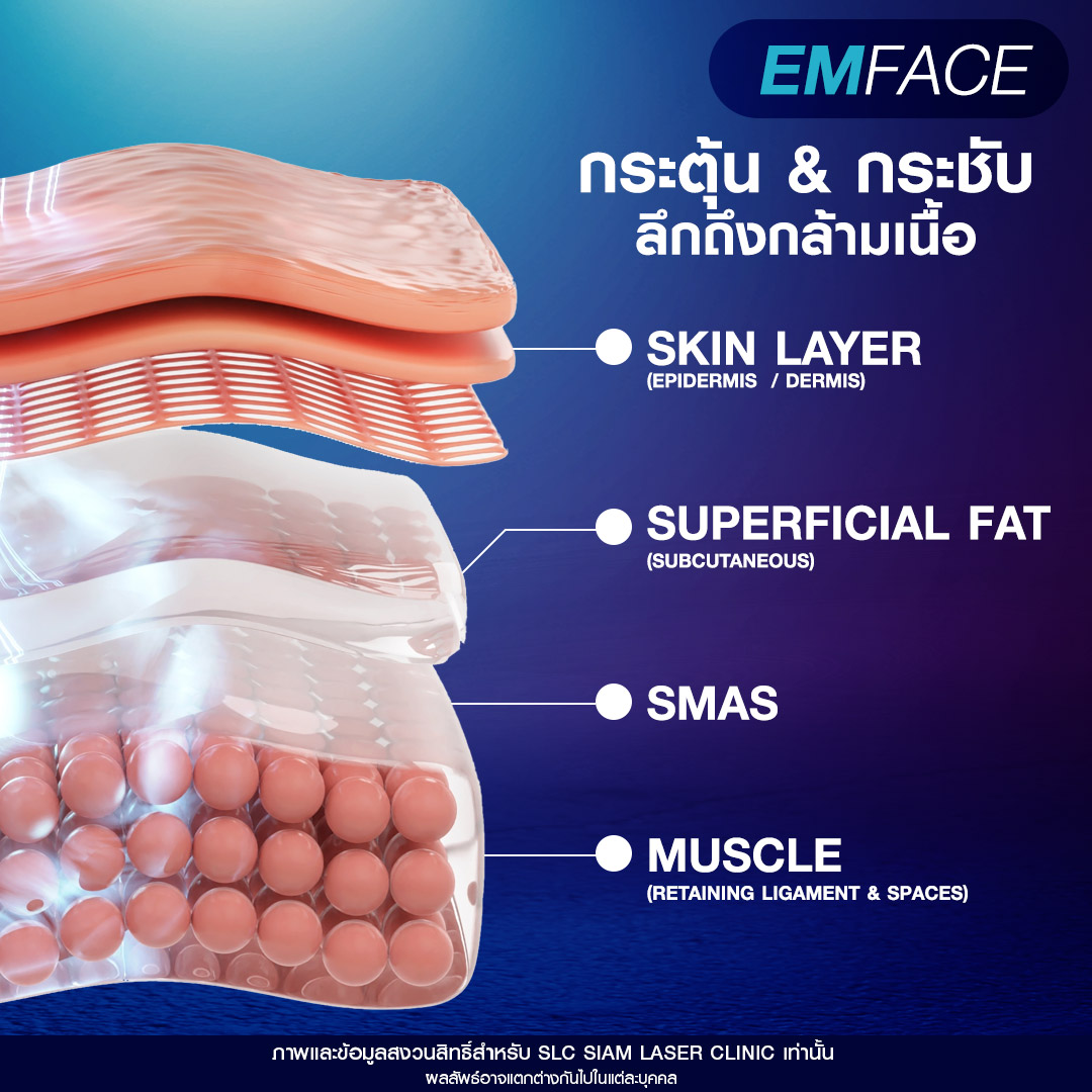  เครื่องยกหน้า, เครื่องยกกระชับ, ยกกระชับหน้า, Ulthera, Volnewmer, MPT 4 D Lift, Emface, Morpheus 8, Thermage, หัตถการยกกระชับหน้า, เครื่องยกกระชับหน้า