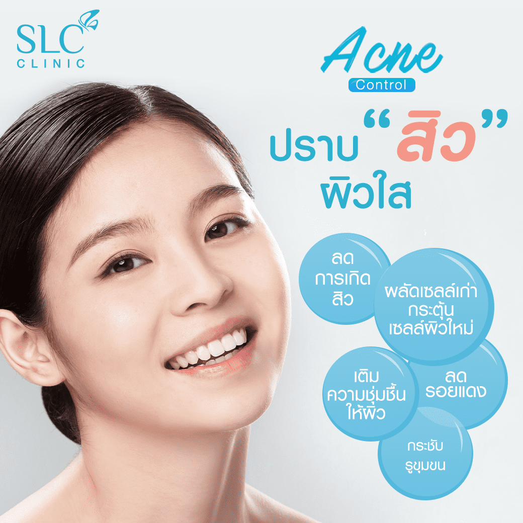 Acne Control Plus+, ลดสิว, ลดรอยดำ, หน้าใส, มาร์คผิว